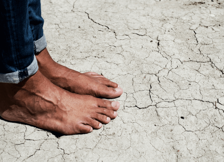 Jalgade hooldus ja kuiv nahk. Jalad kuivavad ja tekivad kuivad paksud kohad talla alla?